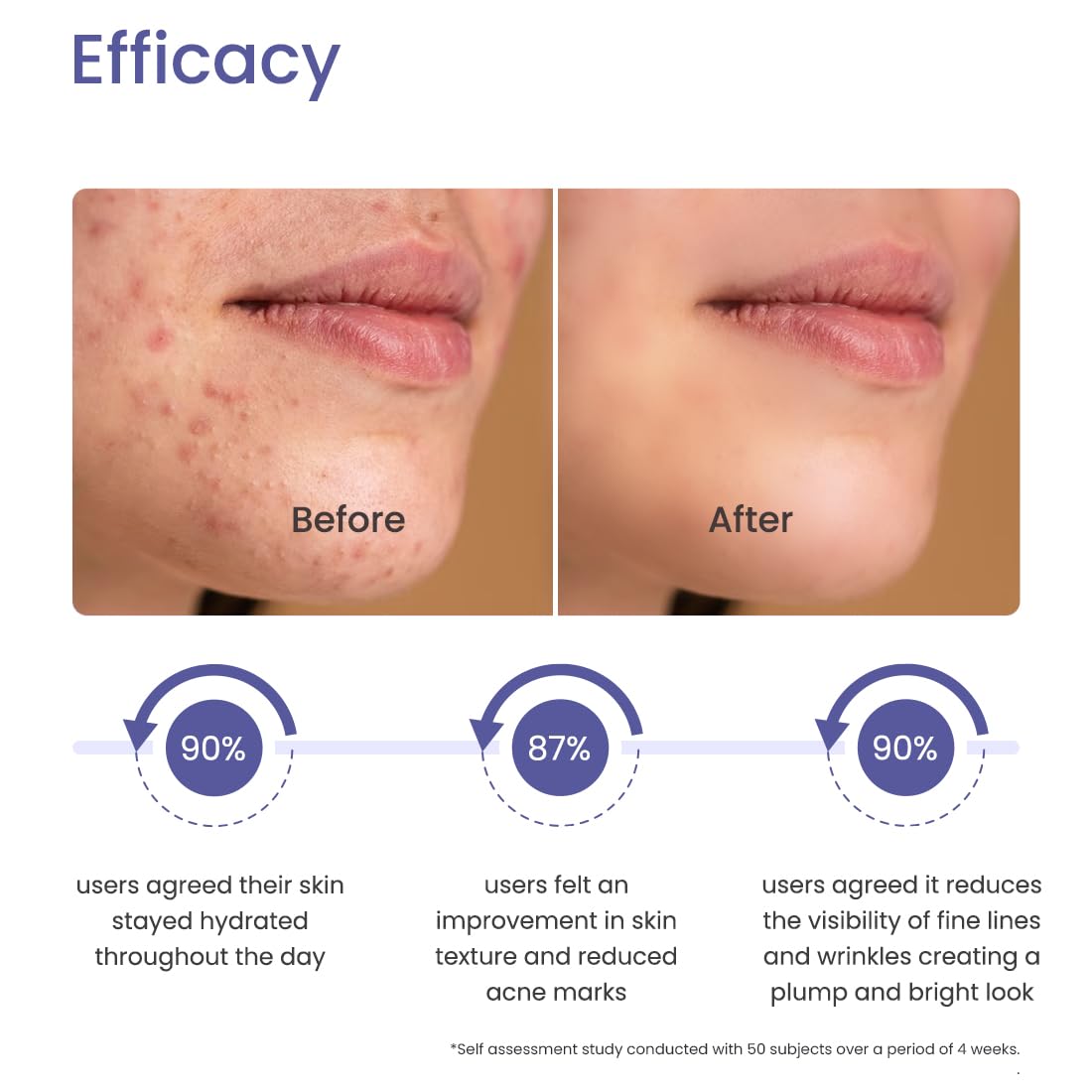 Earth Rhythm 10% Niacinamide Serum + Hyaluronic Acid Face Serum | For Acne Prone, Oily & Sensitive Skin | Evens Out Skin Tone, Improves Texture, Plumps & Hydrates Skin | Men & Women-15ml