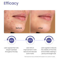 Earth Rhythm 10% Niacinamide Serum + Hyaluronic Acid Face Serum | For Acne Prone, Oily & Sensitive Skin | Evens Out Skin Tone, Improves Texture, Plumps & Hydrates Skin | Men & Women-15ml