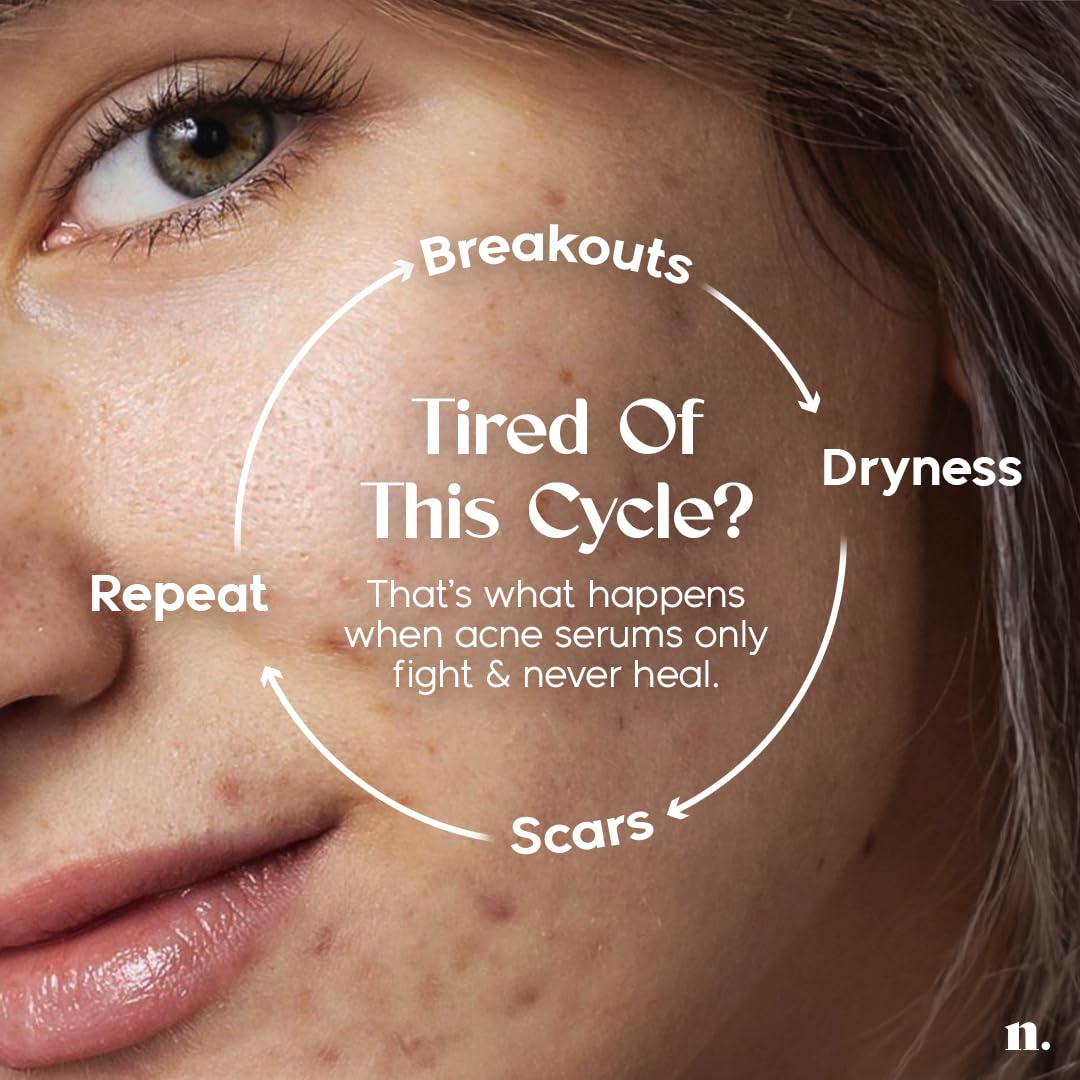 Numour No Breakouts Tonight| Dual Acne face Serum 20ml | 8% Actives 2% Encapsulated Salicylic + 4% Niacinamide + Azelaic Acid & Zinc | Acne‑Prone & Sensitive Skin