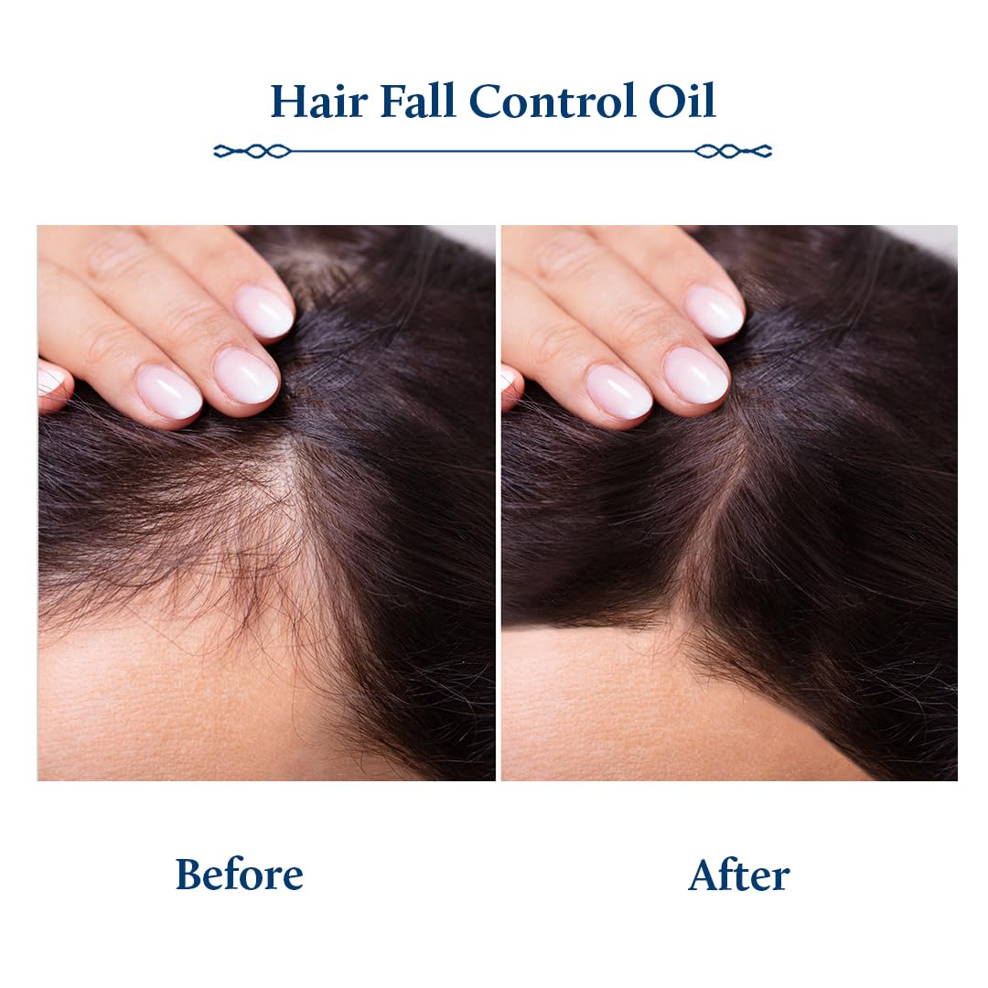 Blue Nectar Briganantadi Hair Fall control & Healthy Scalp Oil | Plant Based Non Sticky Hair Oil for Hair growth | Perfect Hair Fall Oil for Women & Men (9 Herbs, 200 ml)