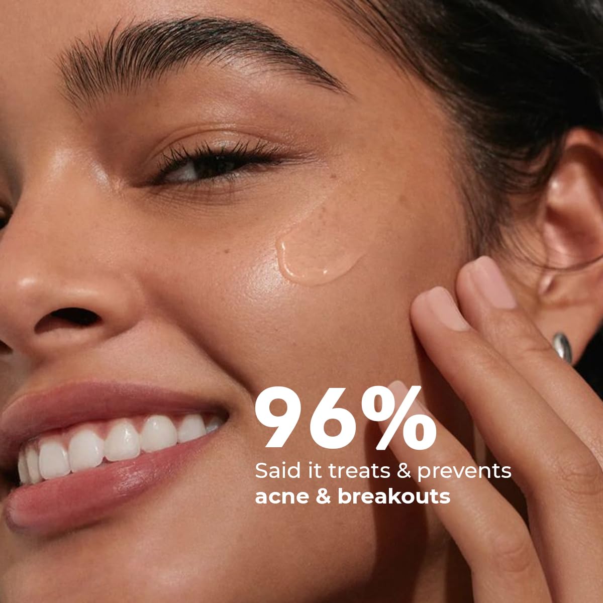 Conscious Chemist 2% Salicylic Acid Serum | 30ml | Face Serum for Acne, Blackheads & Opne Pores, Reduce Excess Oil & Bumpy Texture, BHA Based Exfoliant for Acne, Face Serum for Men & Women - Flashfix