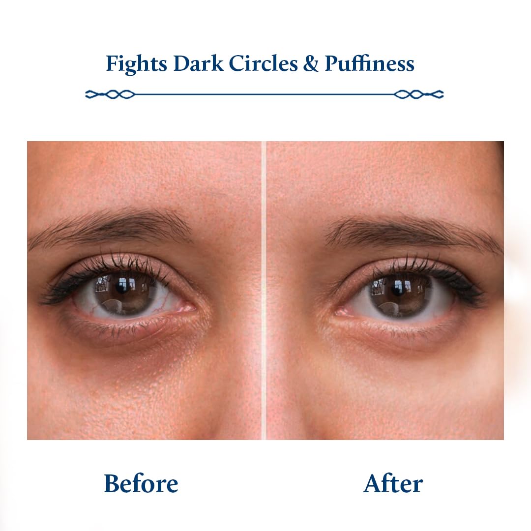 Blue Nectar Under Eye Serum with Plant Based Niacinamide from Potato Starch Papaya Dark Circles Serum with Advance Skin Firming Brightening Form (17 Herbs, 30ml)