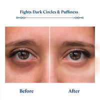 Blue Nectar Under Eye Serum with Plant Based Niacinamide from Potato Starch Papaya Dark Circles Serum with Advance Skin Firming Brightening Form (17 Herbs, 30ml)