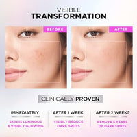 L'OREAL PARIS Glycolic Bright Skin Brightening Serum, 15ml 1% Glycolic Acid For Dark Spots, Pigmentation & Uneven Skin Tone & Glycolic Bright Glowing Night Cream, 15ml For All Skin Type (Pack Of 2)