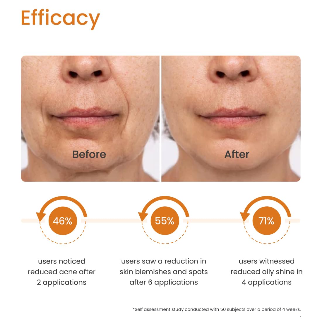Earth Rhythm 20% Vitamin C Face Serum for Glowing & Clear skin with 1.5% Hyaluronic & 2% Salicylic Acid | Hydrates Moisturizes & Brightens | Suitable for Oily Sensitive & Acne Prone Skin - 15ml