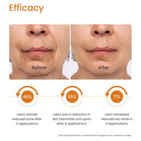 Earth Rhythm 20% Vitamin C Face Serum for Glowing & Clear skin with 1.5% Hyaluronic & 2% Salicylic Acid | Hydrates Moisturizes & Brightens | Suitable for Oily Sensitive & Acne Prone Skin - 15ml