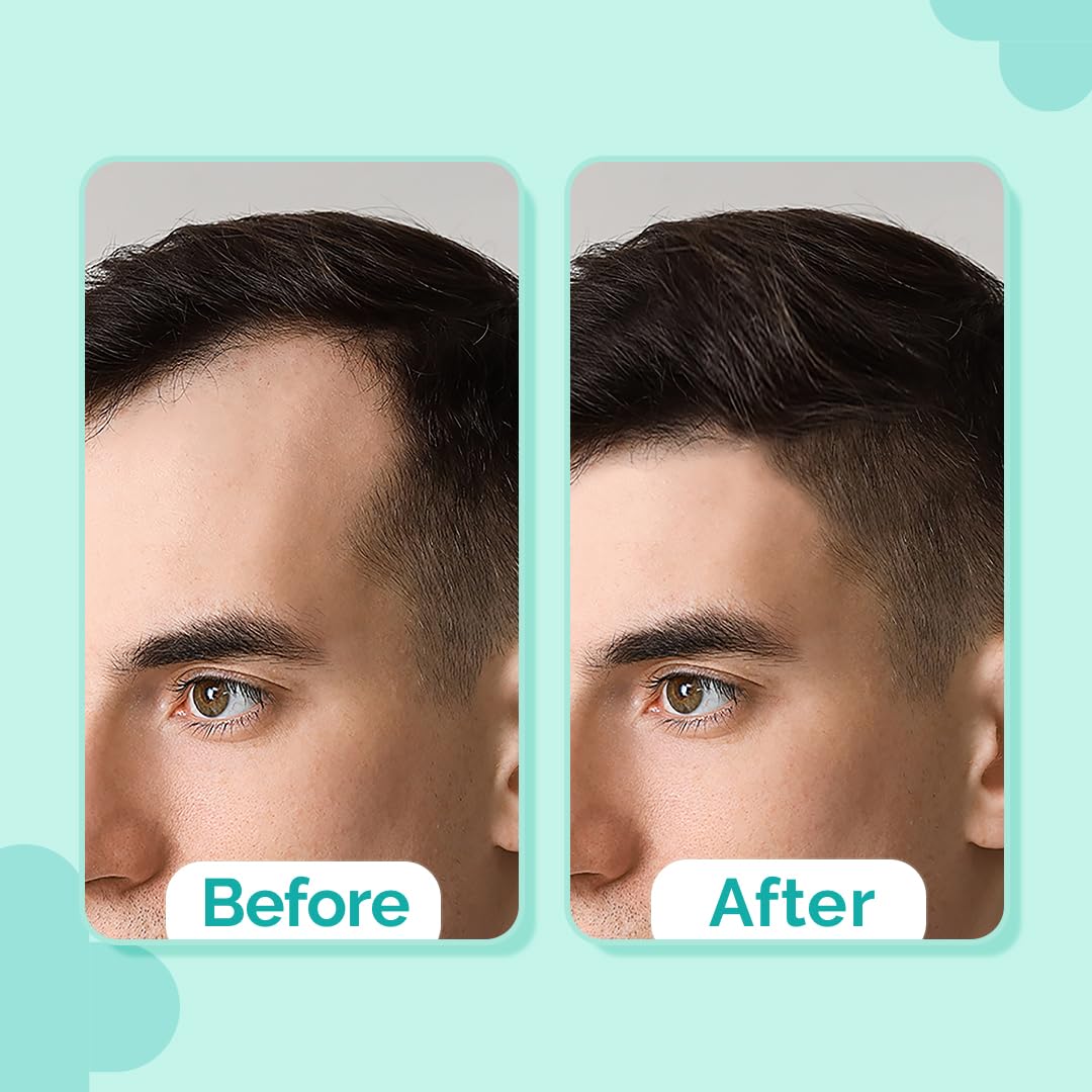 The Derma Co 20% Actives Peptide Stem Cell Hair Growth Serum-30Ml|With 9% Foligen Analupe|4% Anagain|3% Copper Peptide|1% Redensyl|Boosts Hair Growth|Promotes Healthy Scalp|For All Hair Types