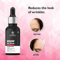 Khadi Organique Rosehip Face Serum For Radiant Glow, Anti Aging, Hydrates & Brighten Skin, Even Out Skin Tone, No Artificial Fragrance Only Used Blend, 30ml