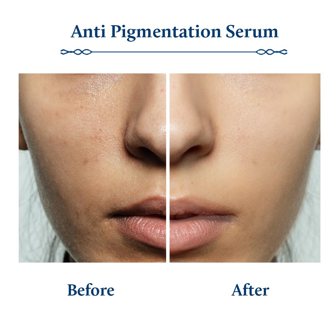 Blue Nectar Rice Water Kojic Acid Face Serum for Pigmentation & Dark Spots Removal | Anti Pigmentation Serum for Face with Mushroom (13 Herbs, 30ml)
