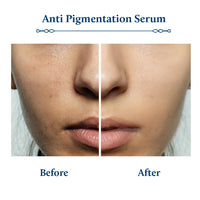 Blue Nectar Rice Water Kojic Acid Face Serum for Pigmentation & Dark Spots Removal | Anti Pigmentation Serum for Face with Mushroom (13 Herbs, 30ml)