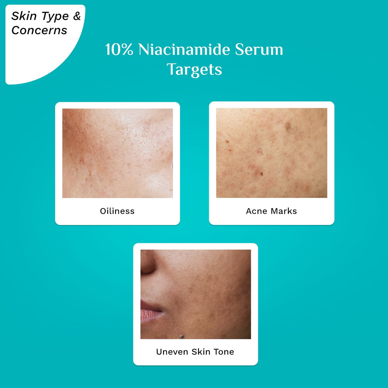 Pilgrim 10% Niacinamide Serum For Acne Marks | Niacinamide Serum For Oily Skin | Fades Blemishes & Dark Spots | Oil Control | Brightens & Evens Skin Tone | Korean Skincare | All Skin Types | Women & Men | 30ml |