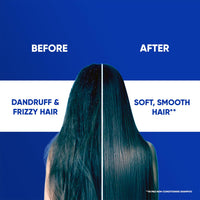 Head & Shoulders 2-in-1 Smooth and Silky Anti Dandruff Shampoo + Conditioner for Women & Men, With Almond Milk (180 ml)
