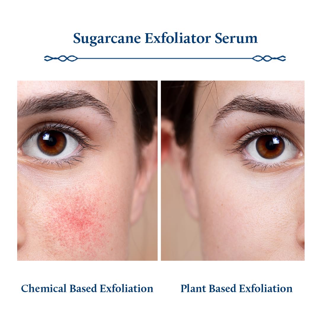 Blue Nectar AHA Exfoliator for Face with Plant Based Glycolic Acid from Sugarcane for Deep Exfoliation | AHA Peeling Solution Exfoliating Face Serum for Blackheads & Tan Removal |10 Min Facial Exfoliation (14 Herbs,30ml)