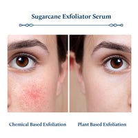 Blue Nectar AHA Exfoliator for Face with Plant Based Glycolic Acid from Sugarcane for Deep Exfoliation | AHA Peeling Solution Exfoliating Face Serum for Blackheads & Tan Removal |10 Min Facial Exfoliation (14 Herbs,30ml)