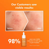 Bellavita C GLOW Face Serum | Vitamin C Serum 10%, 0.1% Ferulic Acid & Hyaluronic Acid | 99% Pure Form of Vitamin C,for Glowing Skin, Reduce Dark Spots Non-Irritating | Non-Sticky | Brightening Vit C Formula For Men and Women |All Skin Types 30 ml