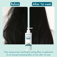 WishCare Hydrating AHA BHA Anti Dandruff Shampoo For Women & Men- Piroctone Olamine, Salicylic Acid, LHA, Climbazole, Pre+Probiotics & Hyaluronic Acid - Paraben & Sulphate Free Shampoo 250ml