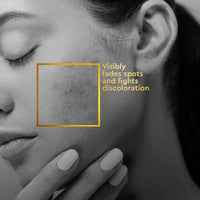 VLCC Clinic ProPerfect Spot Clarifying Face Wash 150 ml - AlphaXTM Complex is known for Spot lightening | Powered by Alpha Arbutin and Niacinamide | visibly fade dark spots, pigmentation