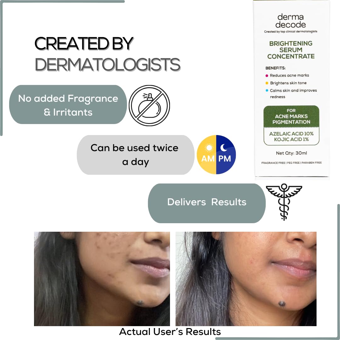 Derma Decode Azelaic Acid Brightening Serum for Glowing Skin - 10% Azelaic Acid, 1% Kojic Acid, Reduces Acne Marks, Dark Spots, Uneven Skin Tone, With Calming Aloe Vera & Cucumber, Fragrance-Free 30ml
