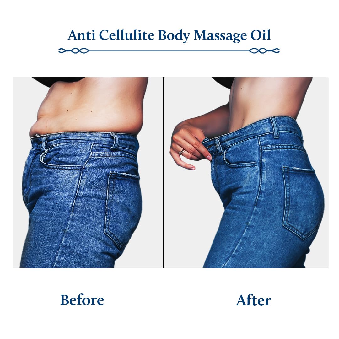 Blue Nectar Anti Cellulite Body Massage Oil with Triphala & Tea Tree Essential Oil | Plant Based Body Oil for Women & Men for Skin Hydration (11 Herbs,100ml)