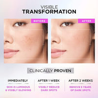 L'Oreal Paris Glycolic Bright Day Cream with SPF 17, 50ml & L'Oreal Paris Glycolic Brightening Serum 30ml