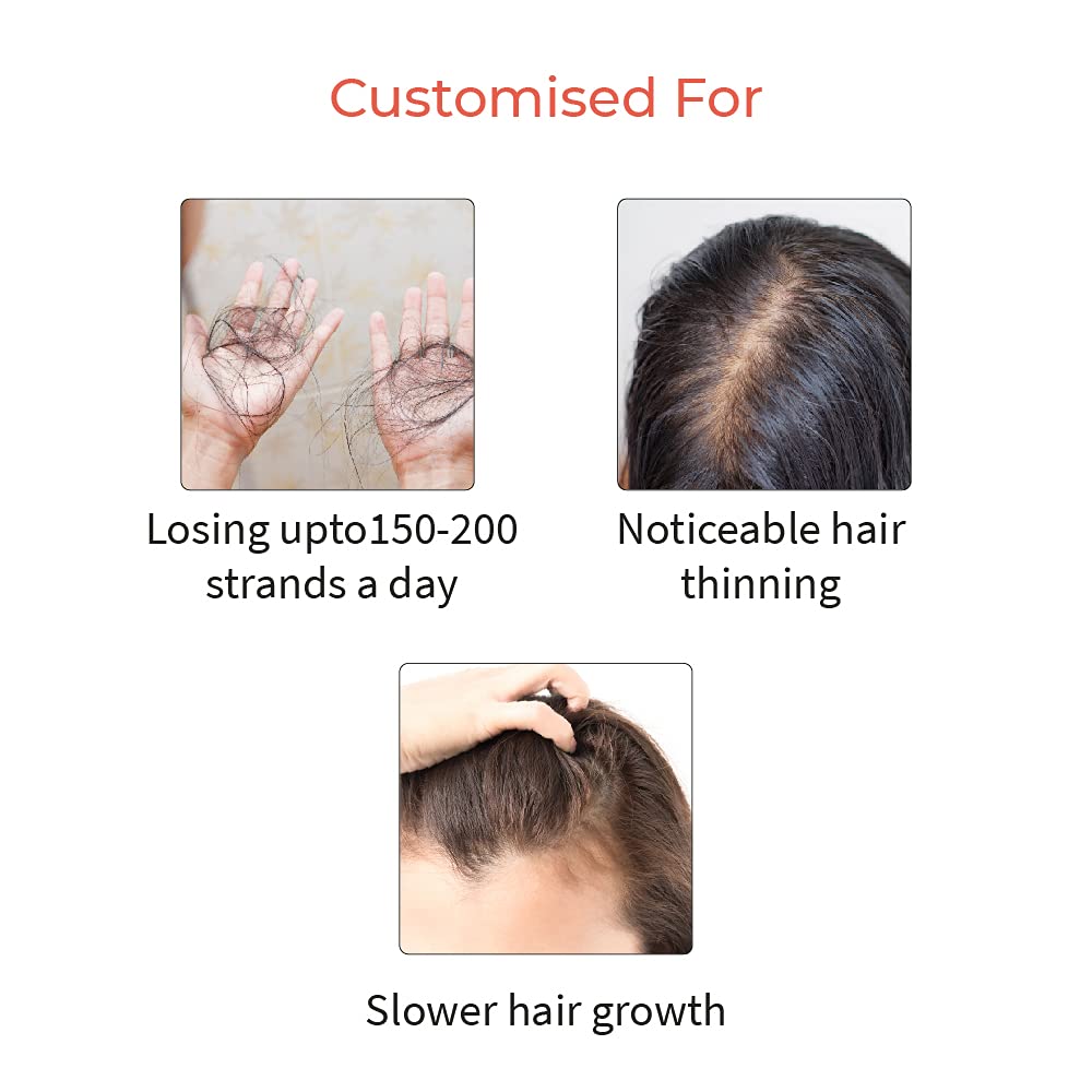 Vedix Hair Serum, Prachay Customized Ayurvedic Hair Serum For Women & Men, With Green Tea, Ginseng & Moringa For Moderate Hair Fall, Reduces Hair Fall - 30 Ml (Packing May Vary, 100 Gm)