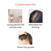 Vedix Hair Serum, Prachay Customized Ayurvedic Hair Serum For Women & Men, With Green Tea, Ginseng & Moringa For Moderate Hair Fall, Reduces Hair Fall - 30 Ml (Packing May Vary, 100 Gm)