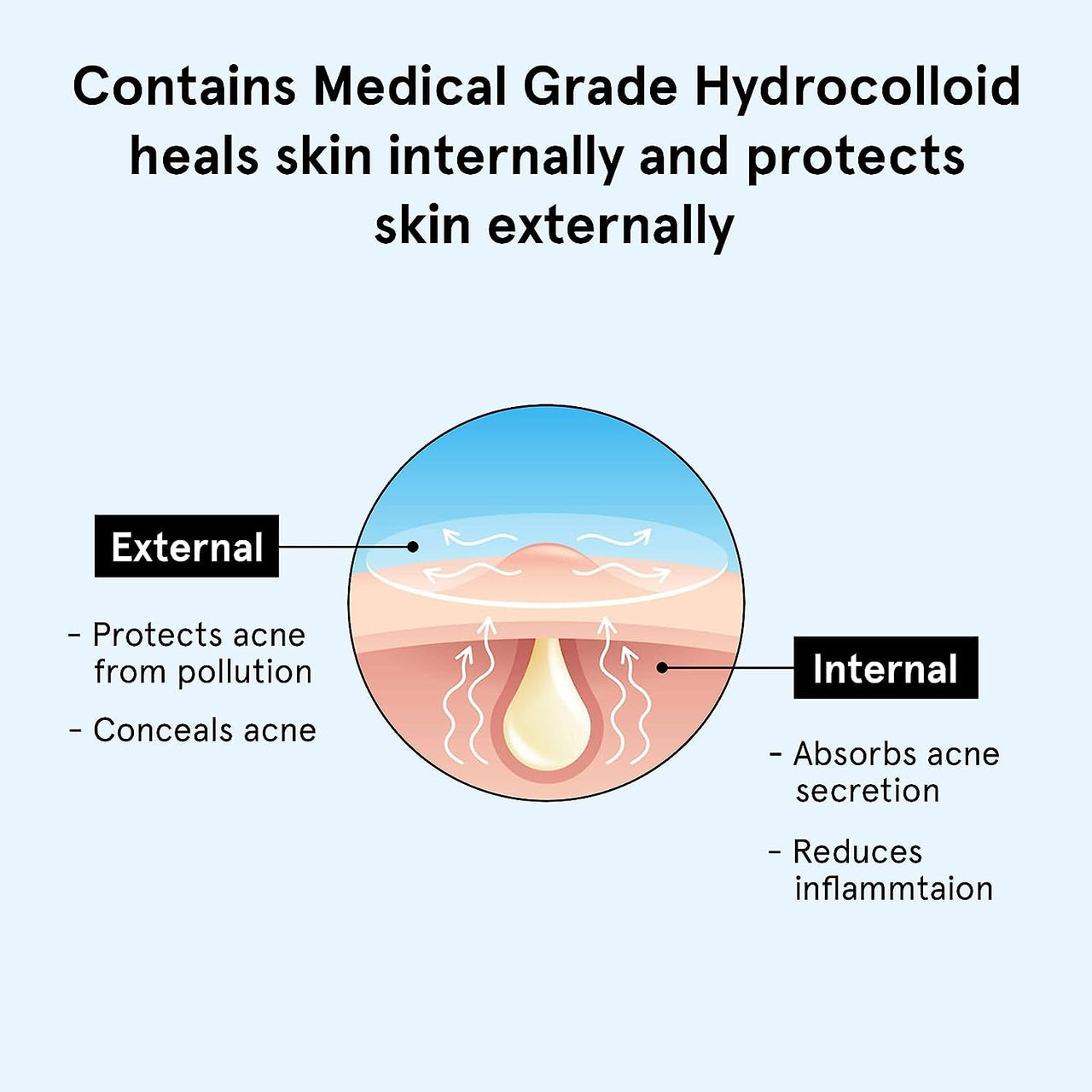 Be Bodywise Snail 96 Mucin Serum 100ml & Hydrocolloid Acne Patch (24 Dots | 3 Sizes) | Absorbs & Flattens Acne Overnight,Soothes, Hydrates & Moisturises Skin | 0.5% Niacinamide, 96% Snail Mucin