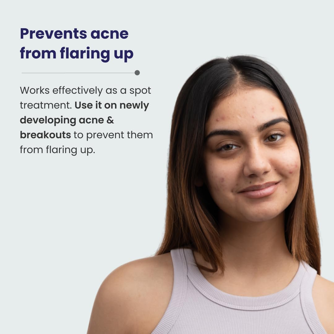 RE' EQUIL Acne Clarifying Gel With Salicylic Acid & Glycolic Acid | For Active Acne & Pimple Treatment | Pimple Removal Gel | Acne-Prone Skin | 20G