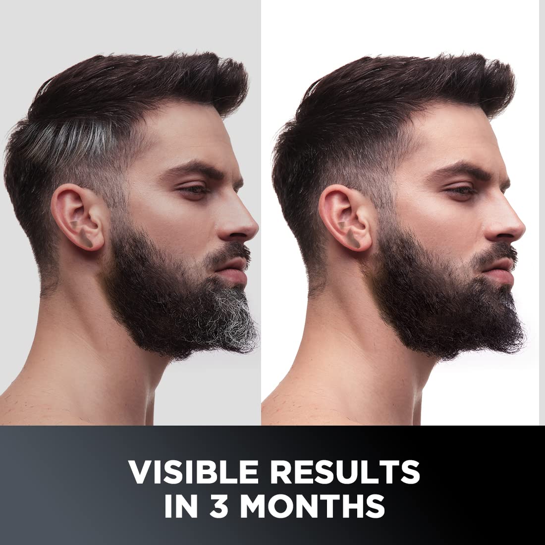 The Man Company Anti-Graying Hair & Beard Cream for Men | Delays Grays | Nourishes | Styles | Boosts Confidence | Toxin-Free | All Hair Types- 75 g