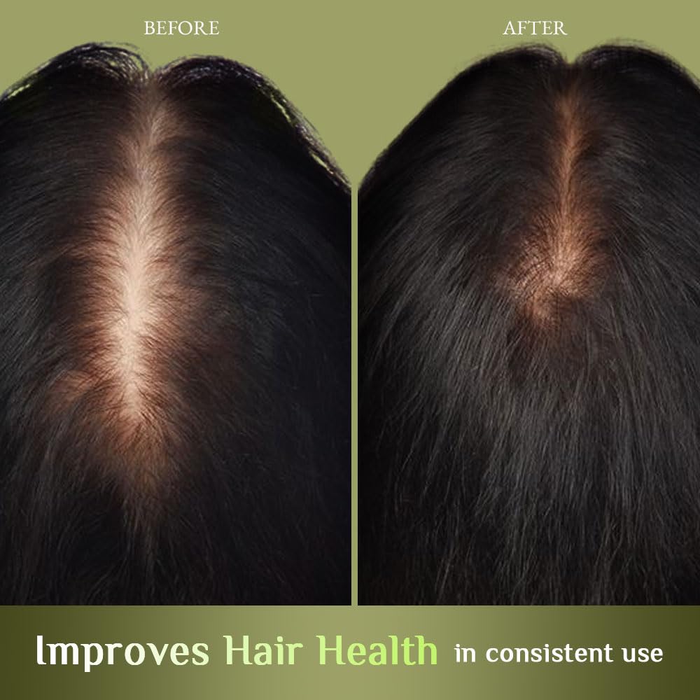 Richfeel Brahmi Jaborandi Hair Oil | Controls Hair Fall | Promotes Hair Growth | Trichologist Developed Formula | For Men & Women | No Mineral Oils or Silicones | 80 ML – Pack of 2