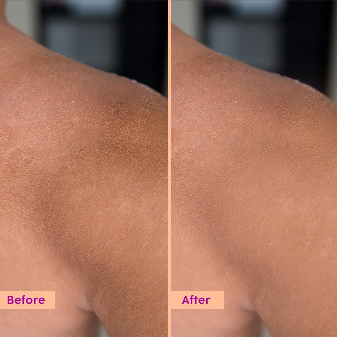PLIX THE PLANT FIX Peaches & Lemon Detan Body Lotion with 5% Niacinamide | 150ml | Reduce Tan, Brighten & Hydrate Skin | Non - Sticky | For Men & Women | Paraben Free