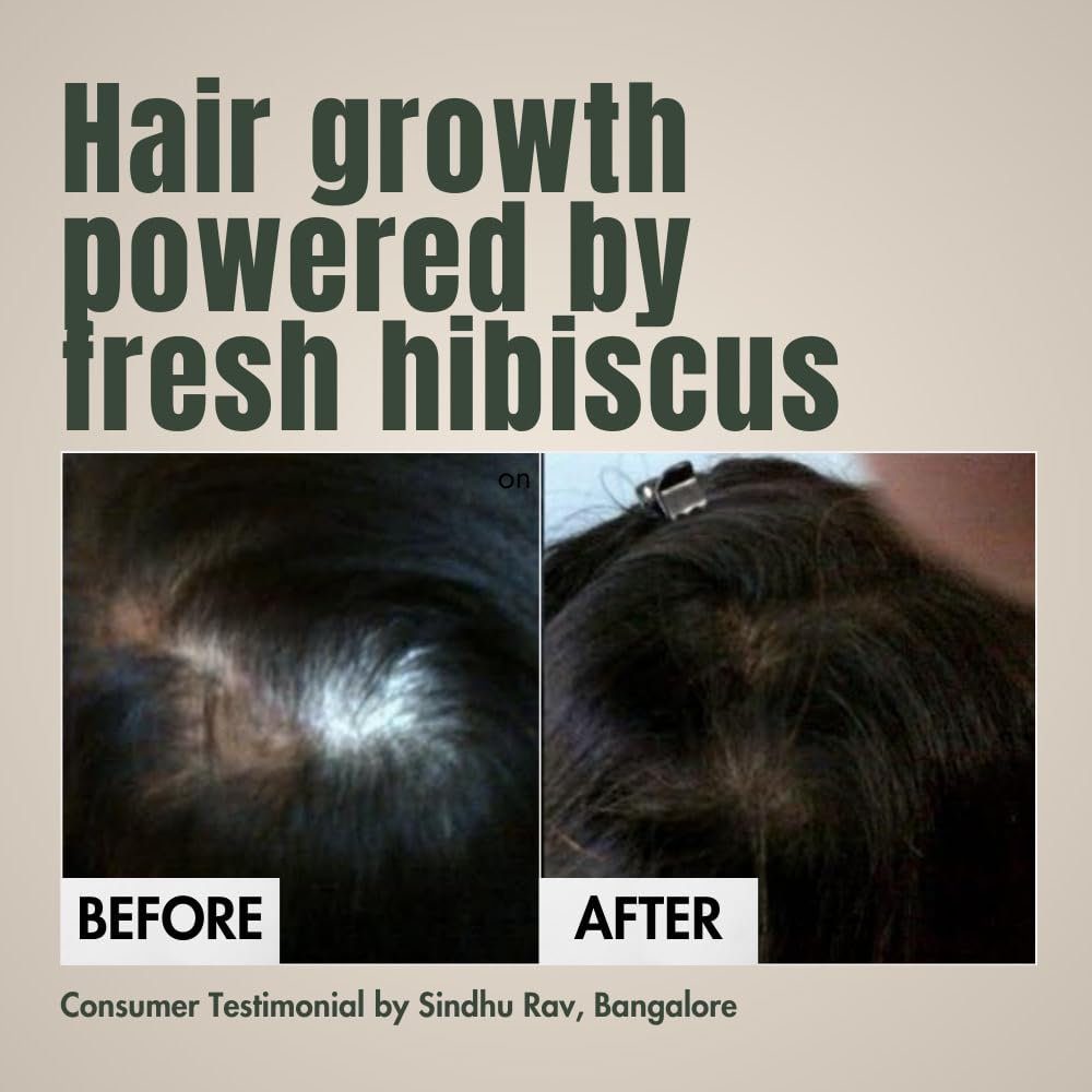 Hibiscus Monkey HM Love Scalp & Hair Oil | Promotes Hair Growth, Reduces Hair Fall | Scalp care | Anti Frizz | Real Hibiscus Flowers, Coconut Milk Oil | Natural | No Mineral Oil, Chemical-Free | 100mL