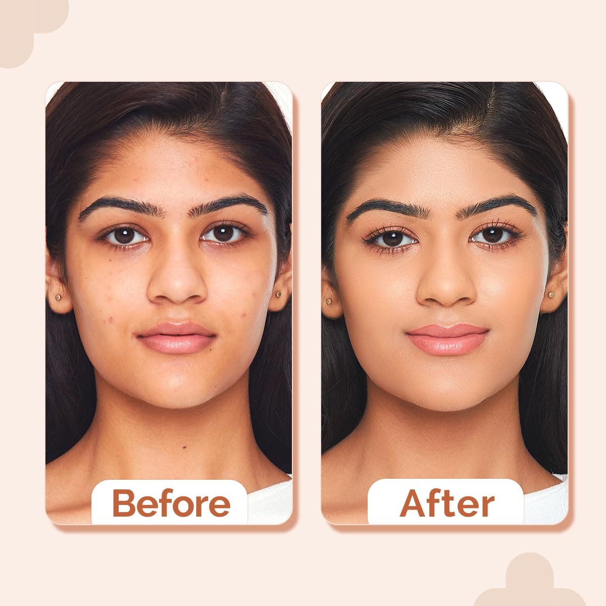 The Derma Co 2% Niacinamide High Coverage Matte Finish Foundation With 1% Hyaluronic Acid & Spf 40 Pa+++ For 12 Hour Long Stay & Oil Control - 05 Peach, For All Skin Type