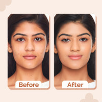 The Derma Co 2% Niacinamide High Coverage Matte Finish Foundation With 1% Hyaluronic Acid & Spf 40 Pa+++ For 12 Hour Long Stay & Oil Control - 05 Peach, For All Skin Type