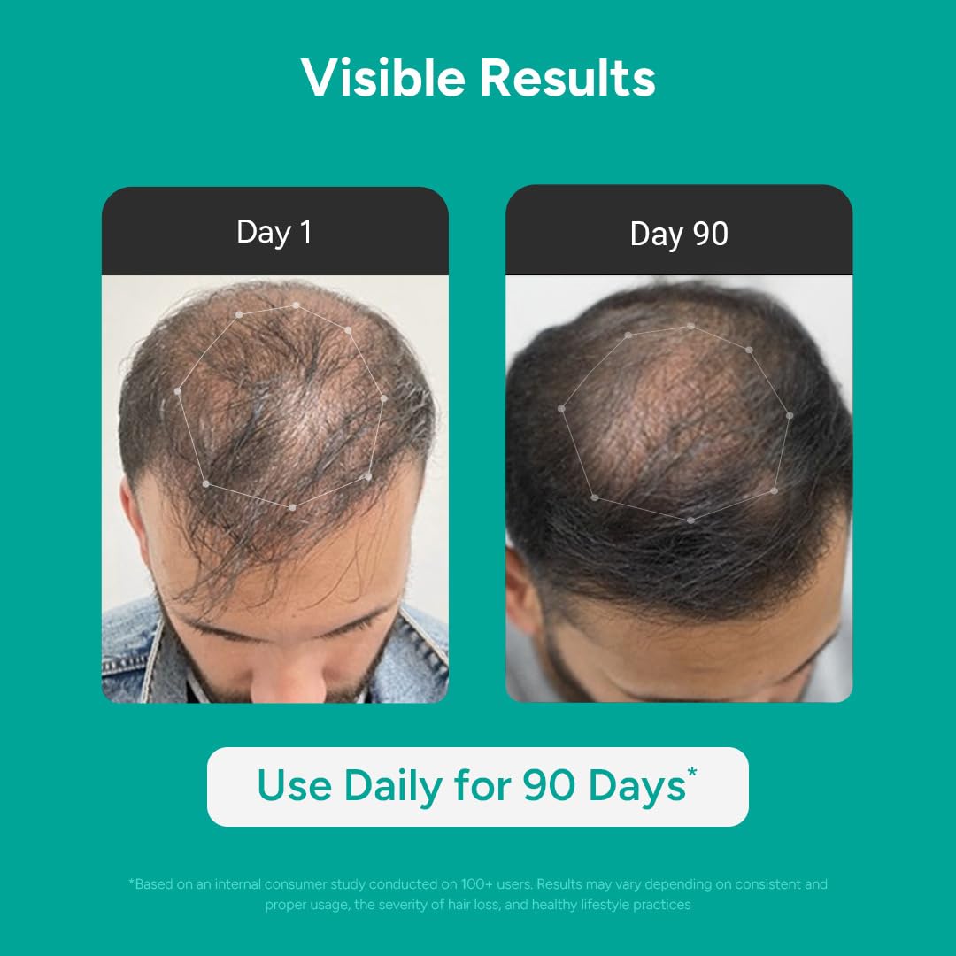 Arata Hair Growth Serum Concentrate with 3% Redensyl, 3% Procapil, 5% Kopexil, Caffeine and Rice Water | No Minoxidil Supports Hair Growth | Helps Reduce Hairfall | Serum For Women and Men | 30 ML