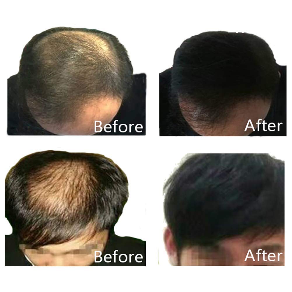 Dexe Hair Building Thickening Fibers For Man & Women, Black, 22 G - Grams