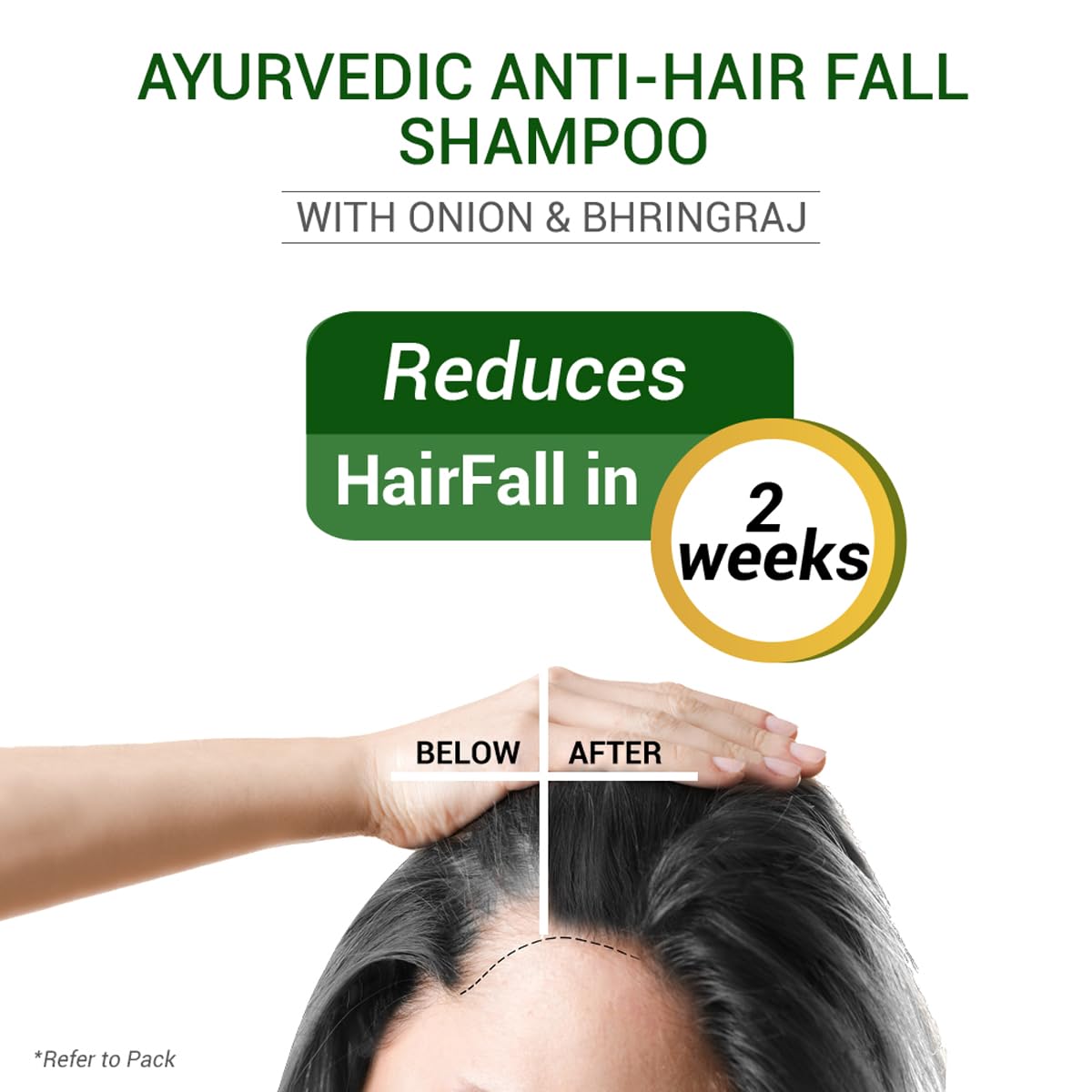 SESA Ayurvedic Hair Oil 100Ml + Ayurvedic Anti Hairfall Shampoo 200Ml Combo Pack Control Hair Fall Nourishes Scalp Help Hair Growth For Men & Women