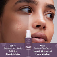 Neude Legend 13 Super Face Serum 30ml with 3x Ceramides, Lactobacillus Ferment, Alpha Arbutin, Rice Water, 13 Multiactives for Barrier Building Re-texturing & Hydration, pH 5.5, for All Skin Types