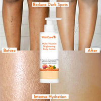 WishCare Multi-Vitamin Brightening Body Lotion - 5% Vitamin C, 5% Niacinamide(B3), Panthenol(B5), Vitamin E, Turmeric & Kakadu Plum - For Men & Women - 200 Ml