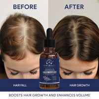 Vamp Beauty Redensyl 2% Hair Growth Serum | With Biotin, Rosemary & Moringa | Reduces Hair Fall, Boosts Regrowth | Non-Sticky, Water-Based | For Men & Women | 50ml