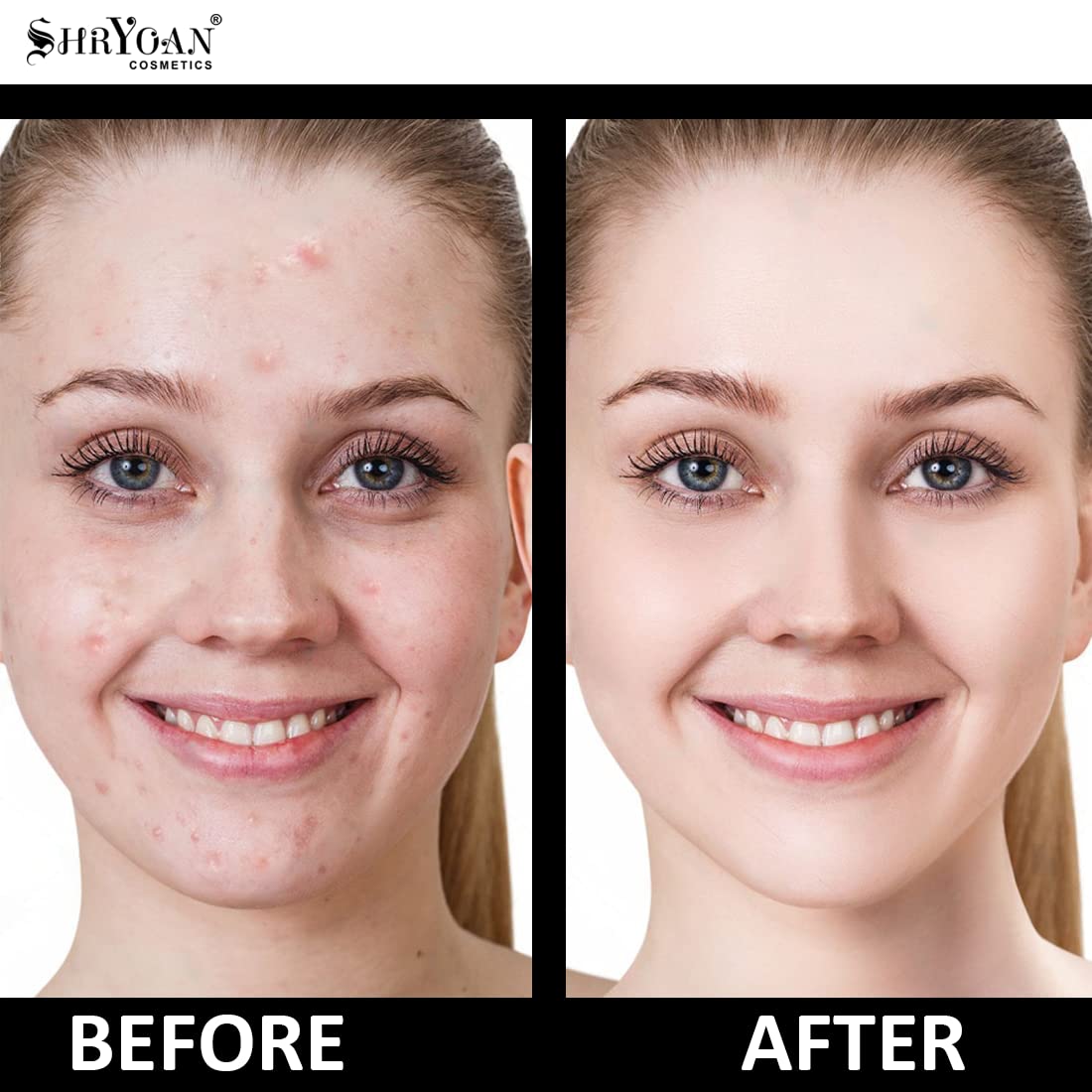 Shryoan Hydra-boost High Coverage Foundation| For Long Lasting Glow & Matte Finish with Full Coverage Foundation (30gm) (Shade 04)
