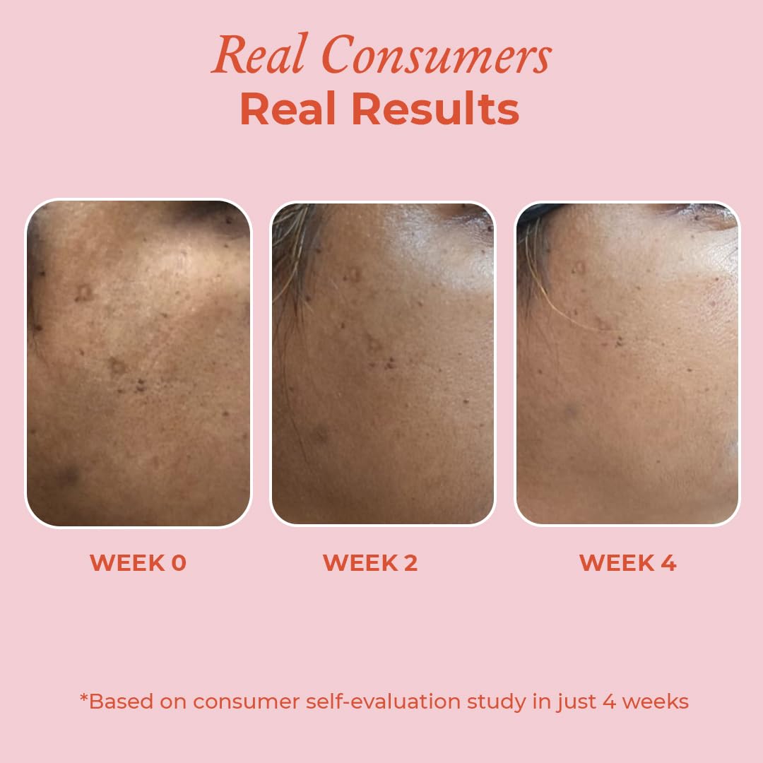 The Pink Foundry 15% Vitamin C Face Birghtening Serum | for Glowing Skin | Improves Dull Skin with 7% Transcutol-P, Phloretin & Rice Water | Light Weight & Non-Greasy | All Skin Types | Vegan | 30ml