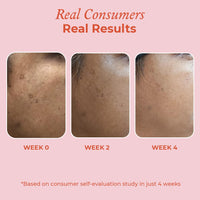 The Pink Foundry 15% Vitamin C Face Birghtening Serum | for Glowing Skin | Improves Dull Skin with 7% Transcutol-P, Phloretin & Rice Water | Light Weight & Non-Greasy | All Skin Types | Vegan | 30ml