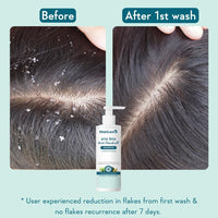 WishCare Hydrating AHA BHA Anti Dandruff Shampoo For Women & Men- Piroctone Olamine, Salicylic Acid, LHA, Climbazole, Pre+Probiotics & Hyaluronic Acid - Paraben & Sulphate Free Shampoo 250ml