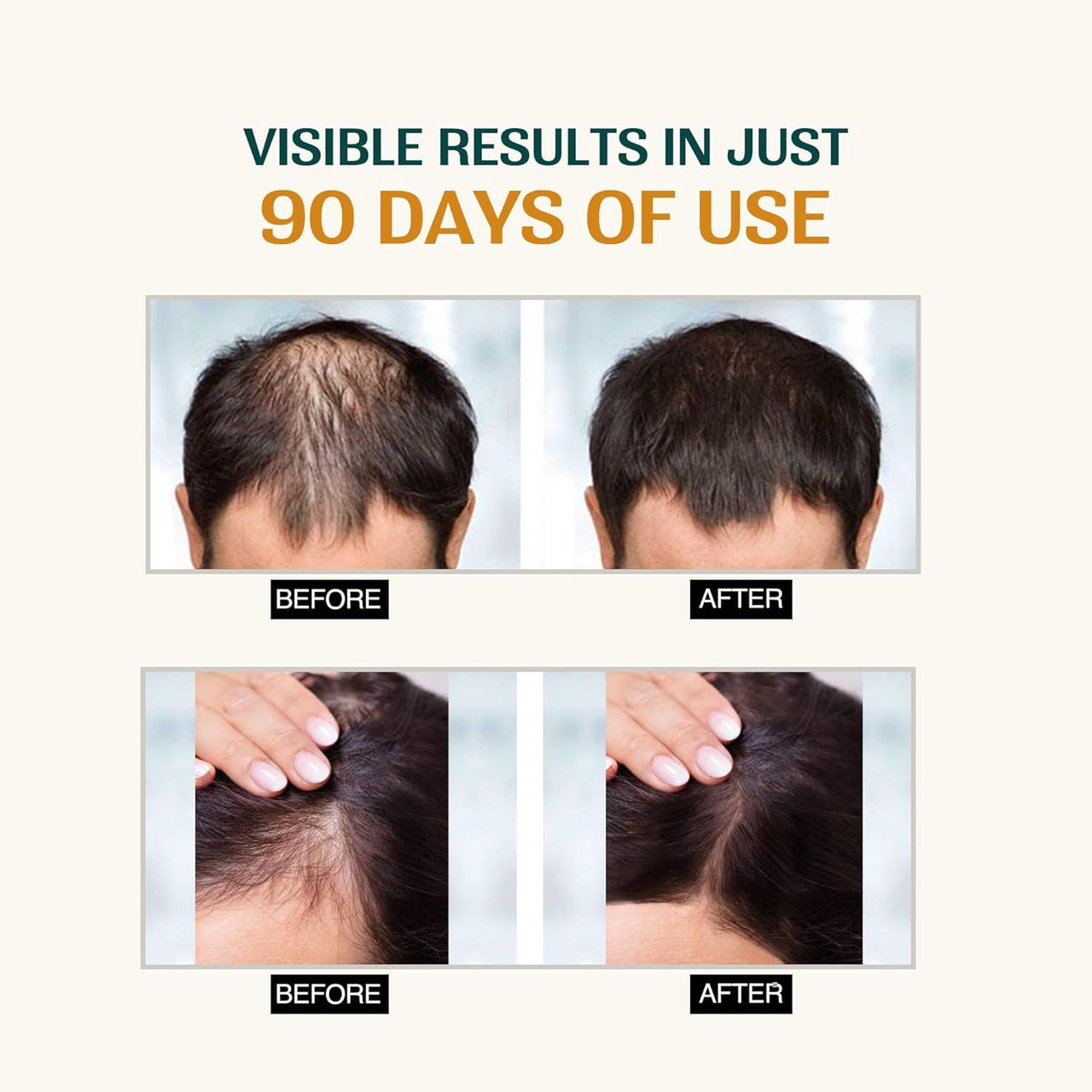 Nourish Mantra Advanced Hair Growth Serum With Rosemary Oil| To Increase Hair Growth, Reduce Hair Fall, Improve Hair Density | Enriched with Rosemary & Redensyl | For Men & Women | 25ml