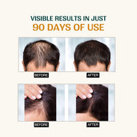 Nourish Mantra Advanced Hair Growth Serum With Rosemary Oil| To Increase Hair Growth, Reduce Hair Fall, Improve Hair Density | Enriched with Rosemary & Redensyl | For Men & Women | 25ml