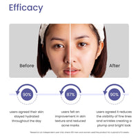 Earth Rhythm 10% Niacinamide Face Serum with Hyaluronic Acid | For Acne Prone, Oily & Sensitive Skin | Evens Out Skin Tone, Improves Texture, Plumps & Hydrates Skin | Men & Women - 30ml