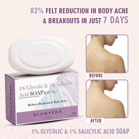 Glamveda Anti Acne 1% ww Glycolic Acid & 1% ww Salicylic Acid Soap | Reduces Dark Spots, Acne Scars & Hyperpigmentation - 75gm Pack of 1