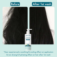 WishCare Ceramide Anti Dandruff Conditioner for Dry & Frizzy Hair - Piroctone Olamine, Pre+Probiotics & Hyaluronic Acid 200ml
