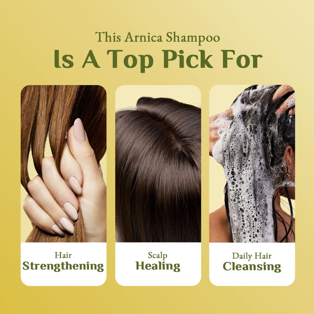 Richfeel Arnica Anti Dandruff Shampoo - Clears Dandruff Flakes, Relieves Excessive Oil, and Soothes Itching | 100 ml